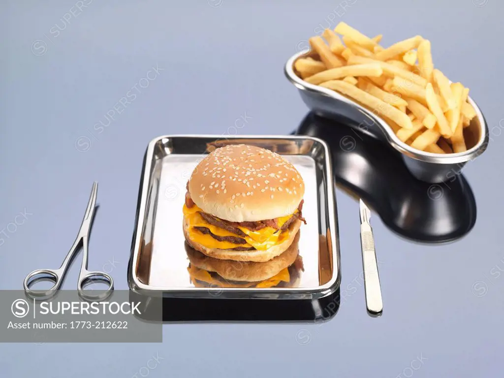 Burger and fries sitting in surgical trays illustrating unhealthy diet
