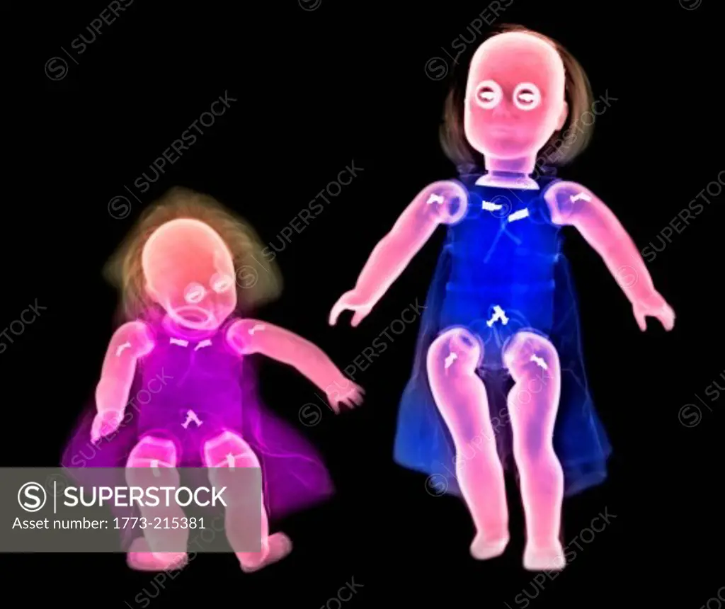 Colorized x-ray of two dolls