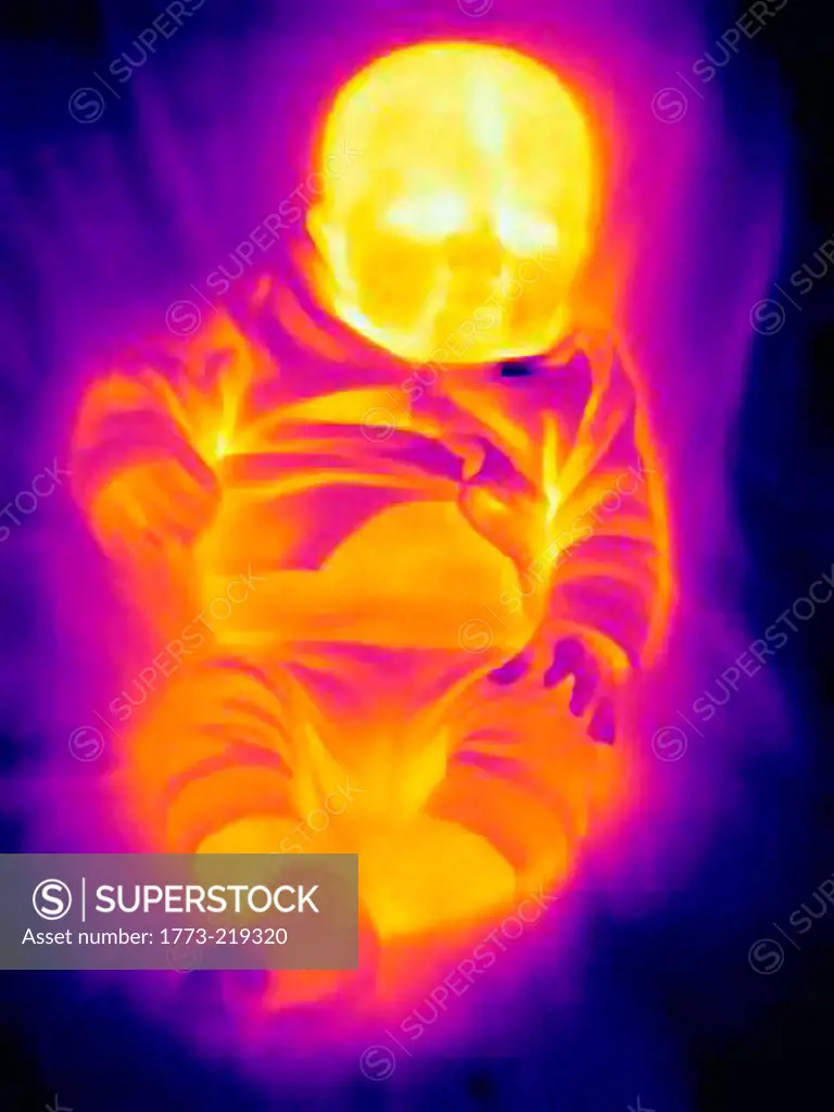 Thermal image of three month old baby