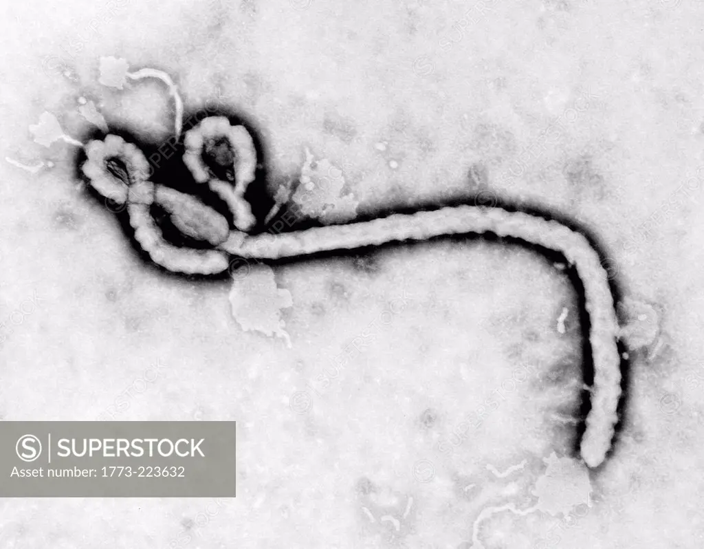 TEM of Ebola virus
