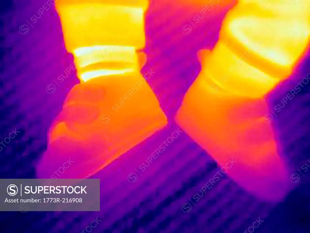 Thermal image of shoes of three month old baby