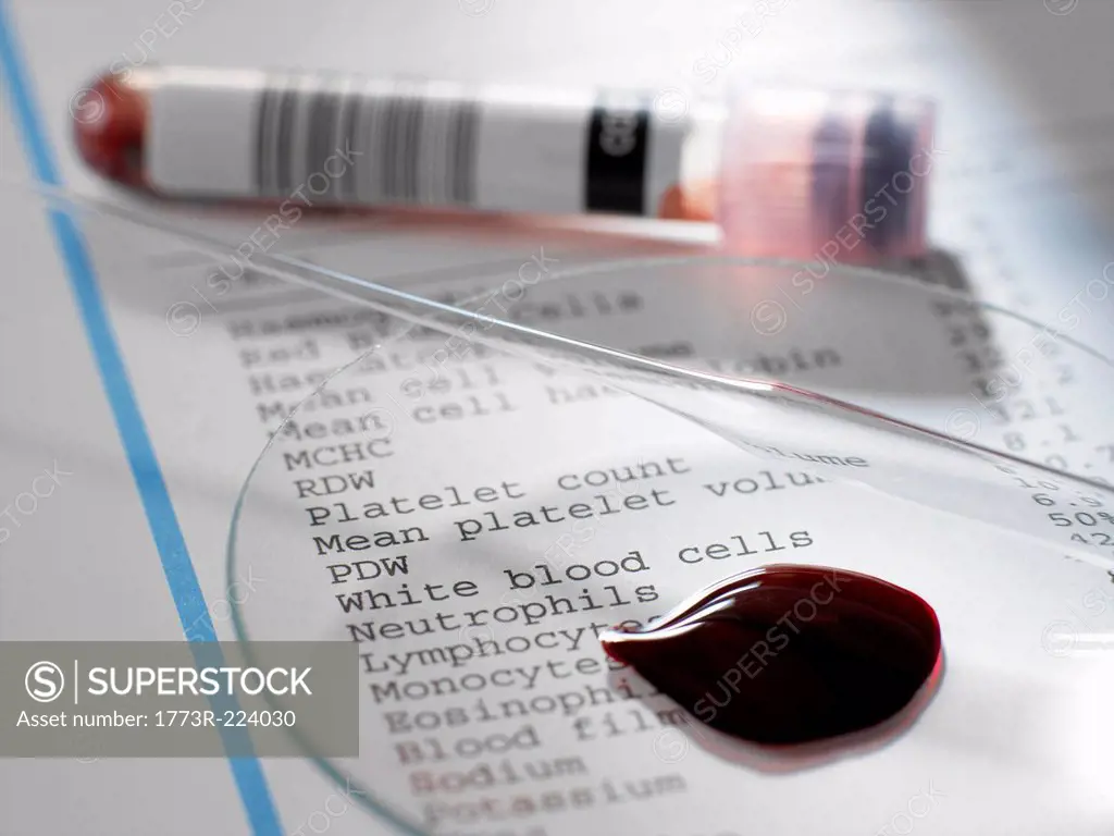 Blood sample with results of clinical analysis of the blood component