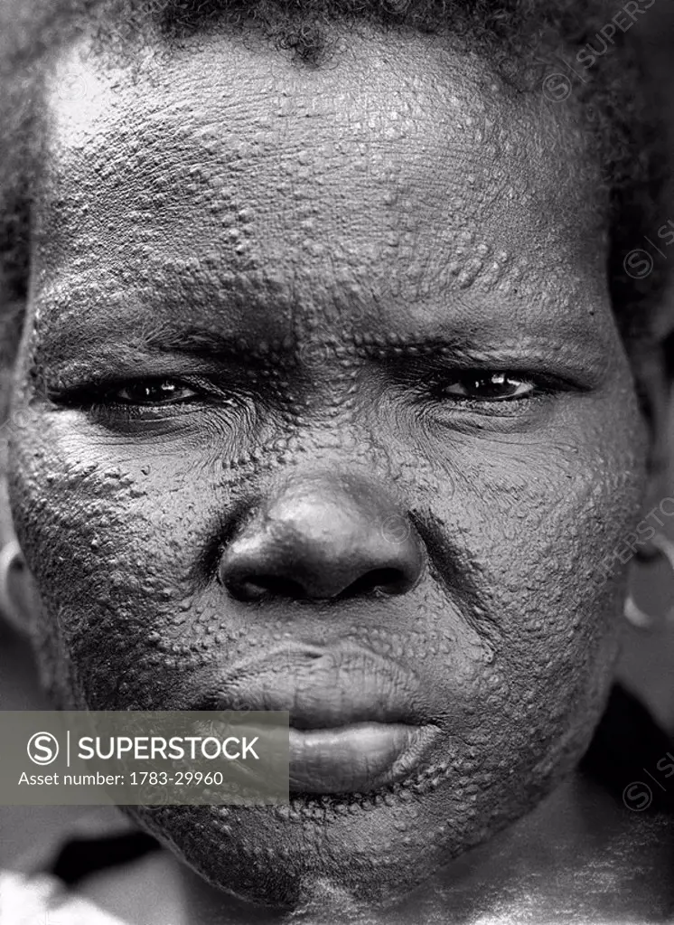 Woman with scarified face, Lankien village, Sudan