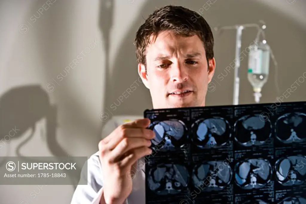 Doctor reviewing test results from CAT scan