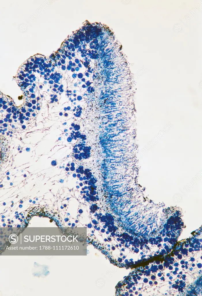 Enlarged section of an apothecium lichen, Xanthoria parietina, seen under a microscope, Teloschistaceae.