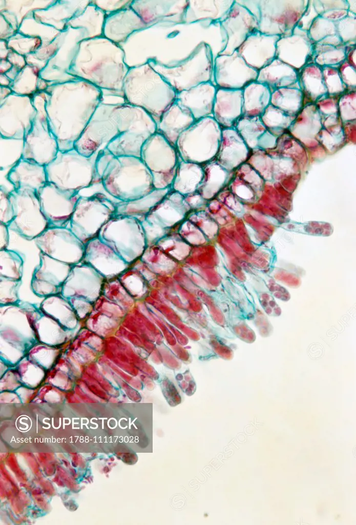 Section of plum leaf attacked by the fungus Taphrina pruni, Ascomycetes, seen under a microscope.