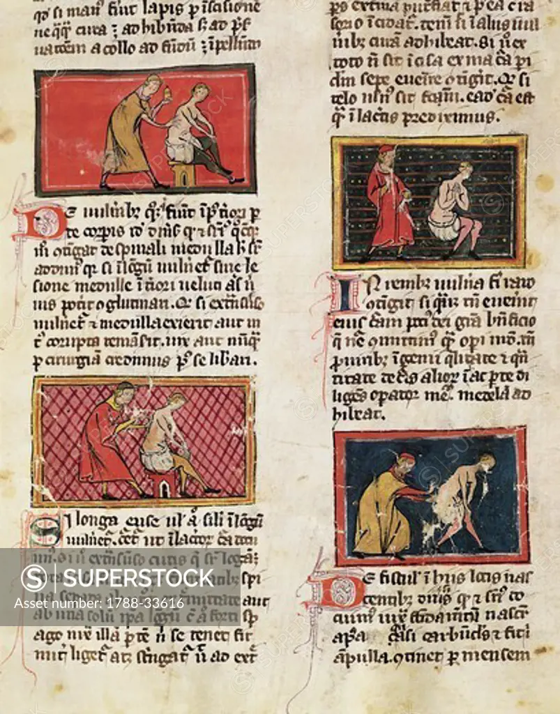 Medical treatments of the sick at the Medical University of Montpellier, miniature from The Surgery of Master Rogerius by Roggerio dei Frugardi or Rogerius Salernitanus, Latin manuscript, France 14th century.