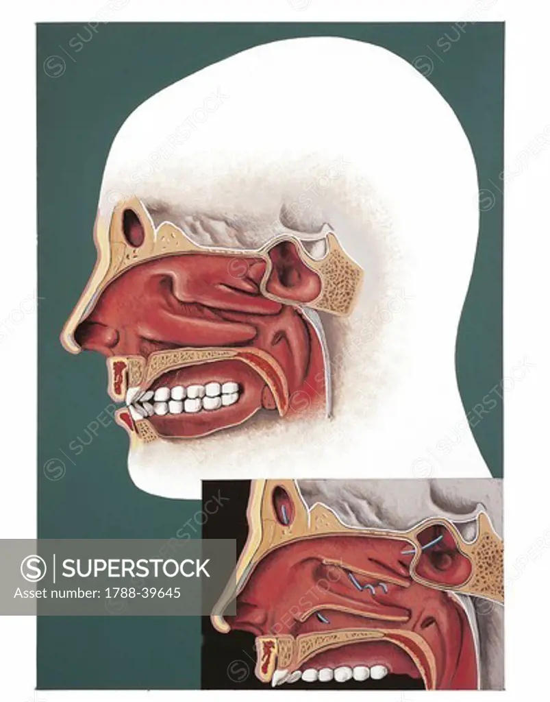 Medicine: Human anatomy, nasal cavity