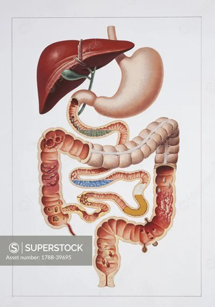 Medicine: Human anatomy, digestive system, the main causes of diarrhea