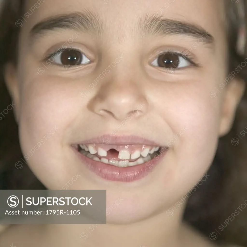 A girl missing a tooth