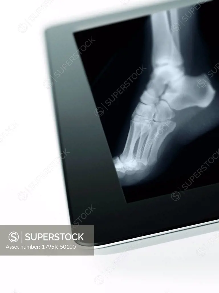 Studio shot of digital tablet with x_ray of human foot