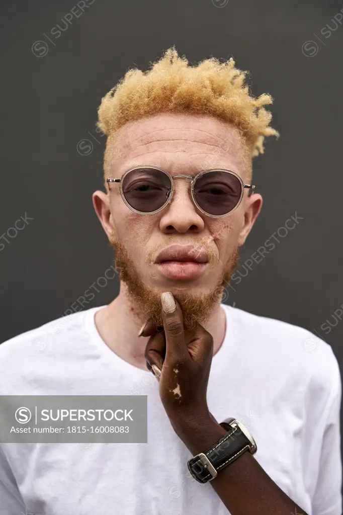 Portrait of Albino man touched by woman's hand