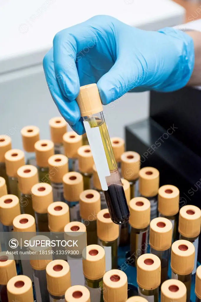 Laboratory technician in analytical laboratory with test tube tray