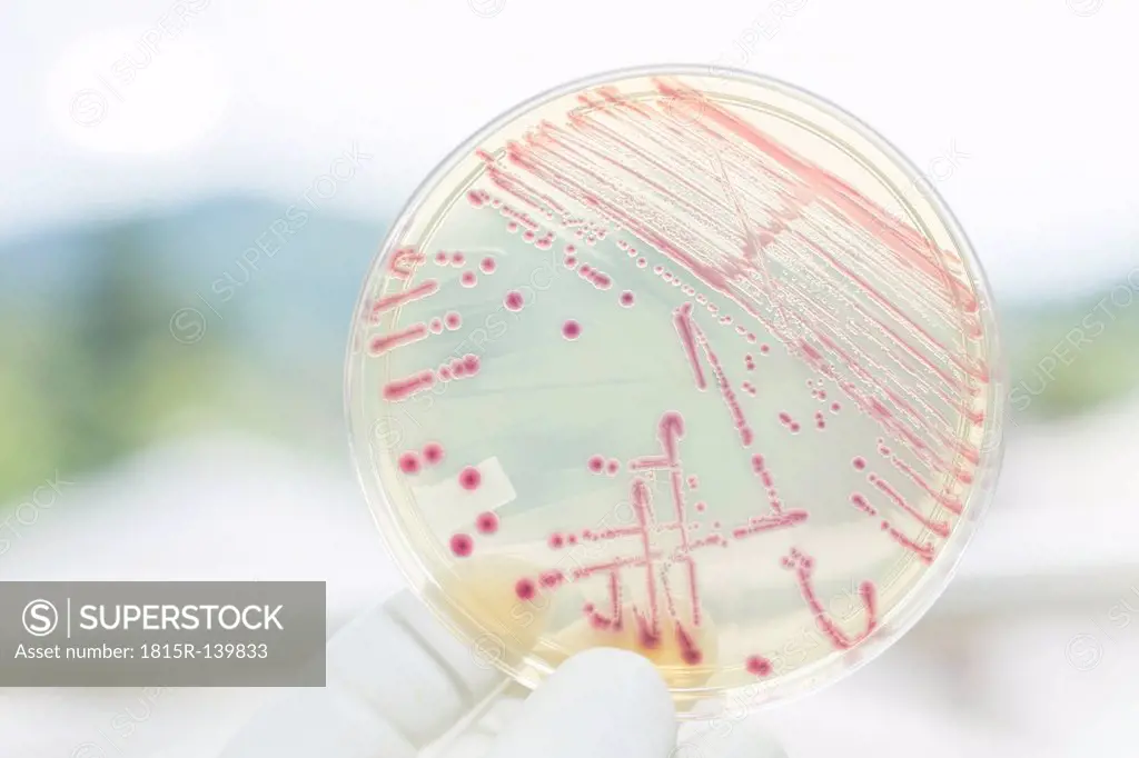 Germany, Freiburg, Human hand holding petri dish with bacteria, close up