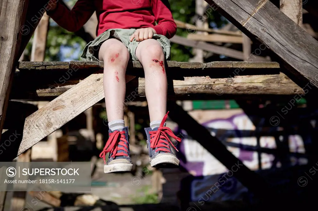 Germany, North Rhine Westphalia, Cologne, Boy injured in playground