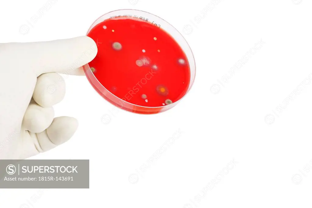Young woman holding petri dish with bacteria