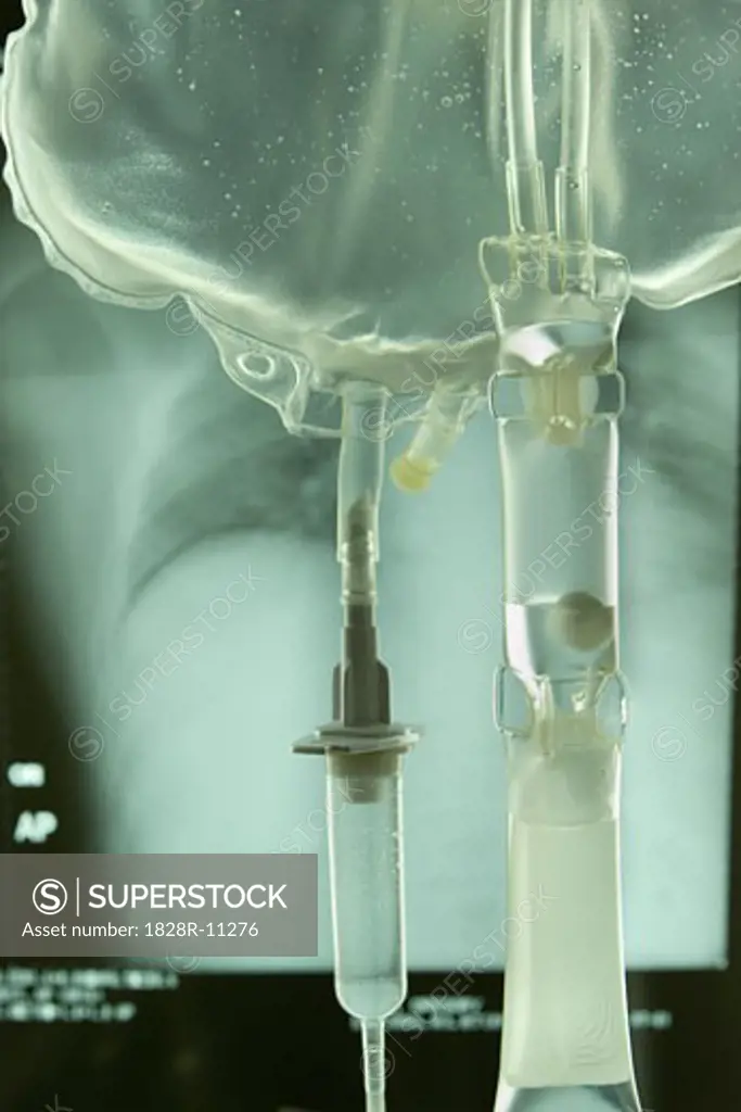 IV Drip Bag and X-Ray   