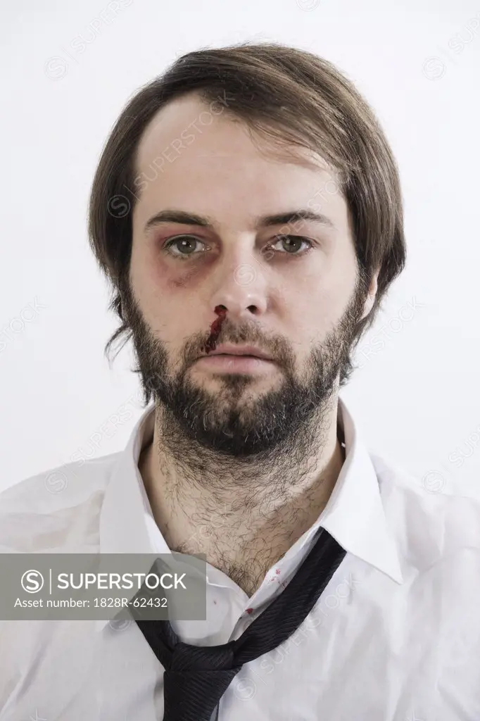 Portrait of Man with Black Eye