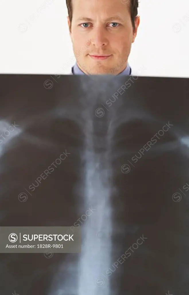 Man Holding Chest X-Ray   