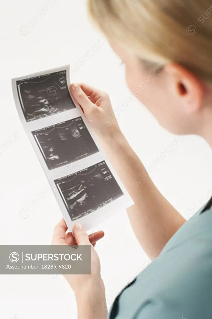 Doctor Looking at Ultrasound   