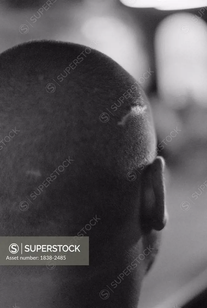 Man with Shaved Head and Scar 