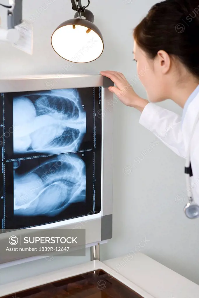 Doctor examining an X_ray