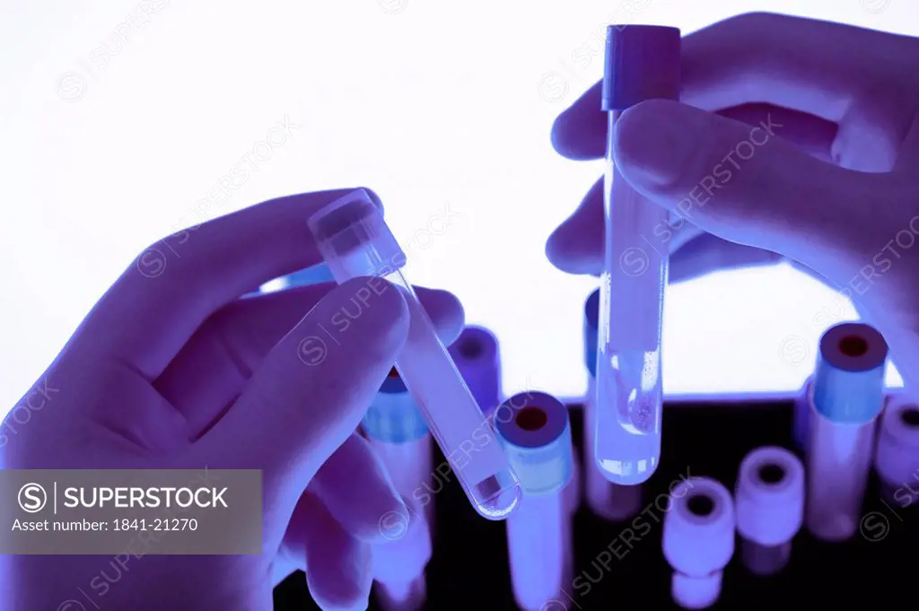 Person holding vials of blood