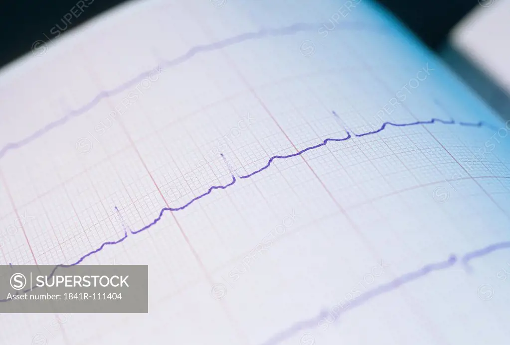 Graph of an ECG heart electrocardiograph