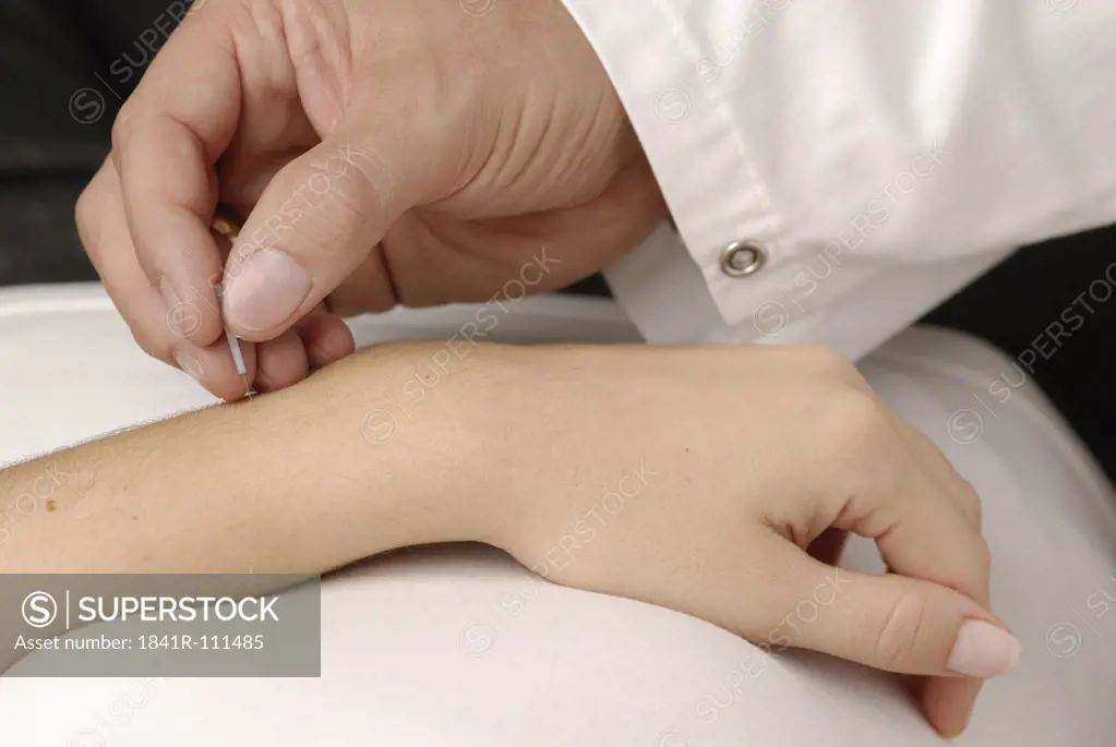 Acupuncture on the crook of the arm