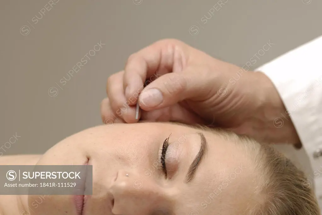 Acupuncture next to ear