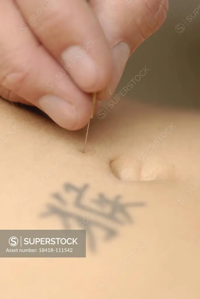 Acupuncture on the leg - BI 36 , UB 36 , V 36