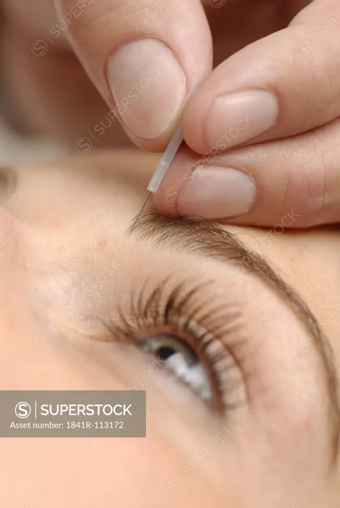 Acupuncture next to ear
