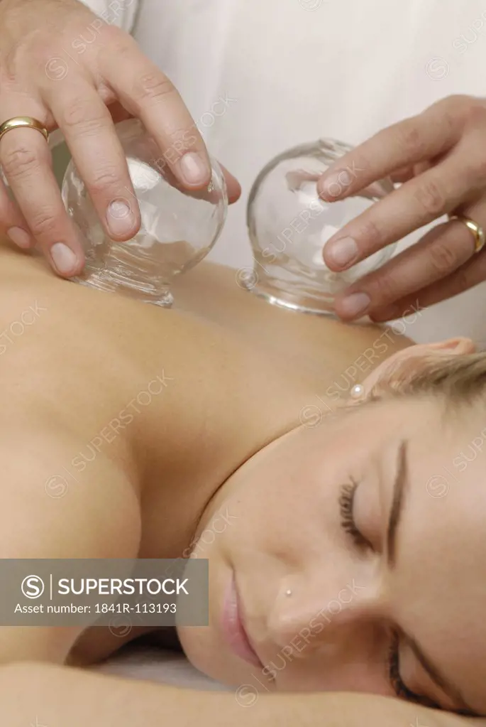 cupping