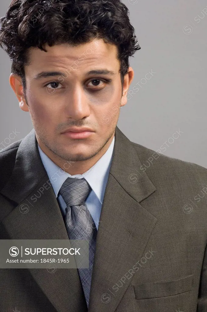 Portrait of a bruised businessman looking sad