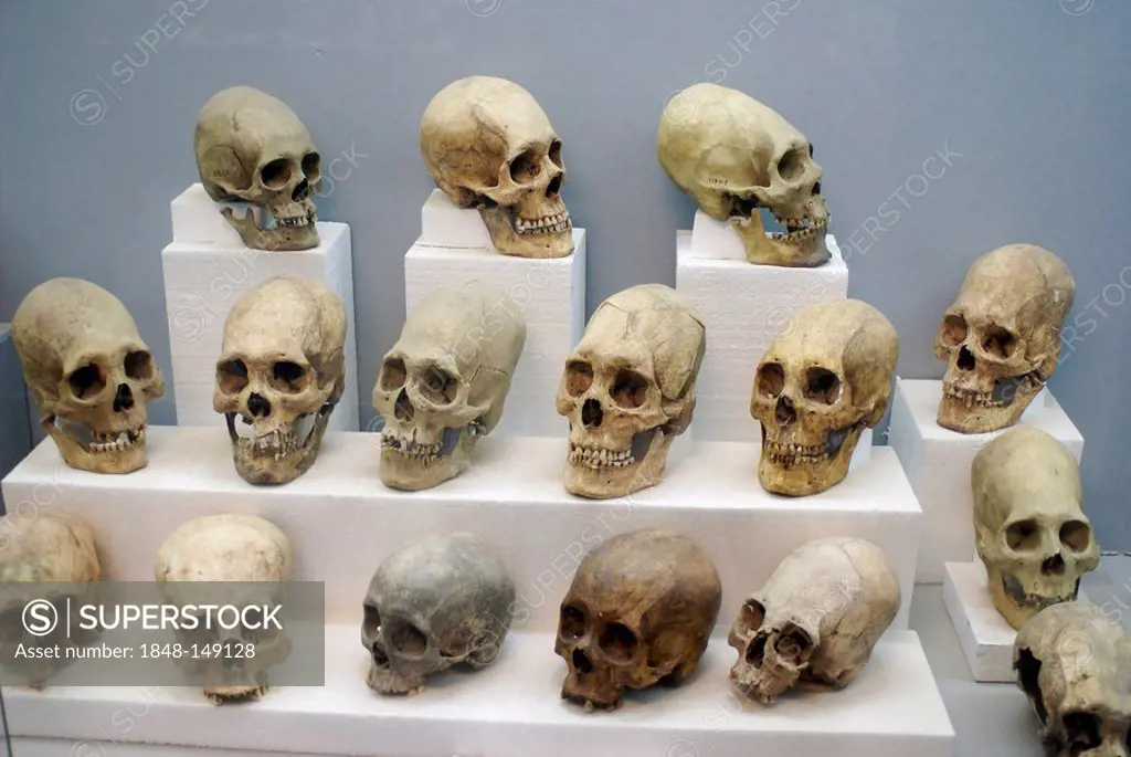 Deformed skulls, discovered in the Tihuanaku temples, Bolivia