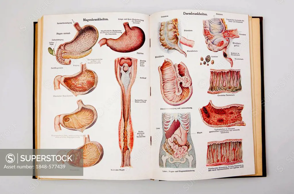 Gastric and intestinal diseases, illustrations from the book 'Dr. F. Koenig's Ratgeber in gesunden und kranken Tagen', German for Dr. F. Koenig 's boo...