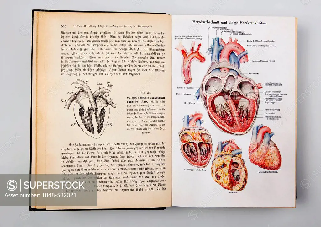Heart diseases, illustrations from the book 'Dr. F. Koenig's Ratgeber in gesunden und kranken Tagen', German for Dr. F. Koenig 's book with advice for...