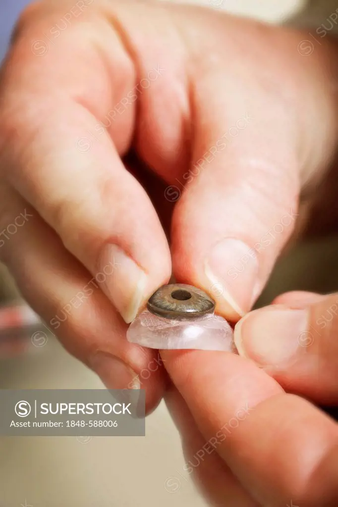 Production of an artificial eye, ocular prosthesis, insertion of the lens