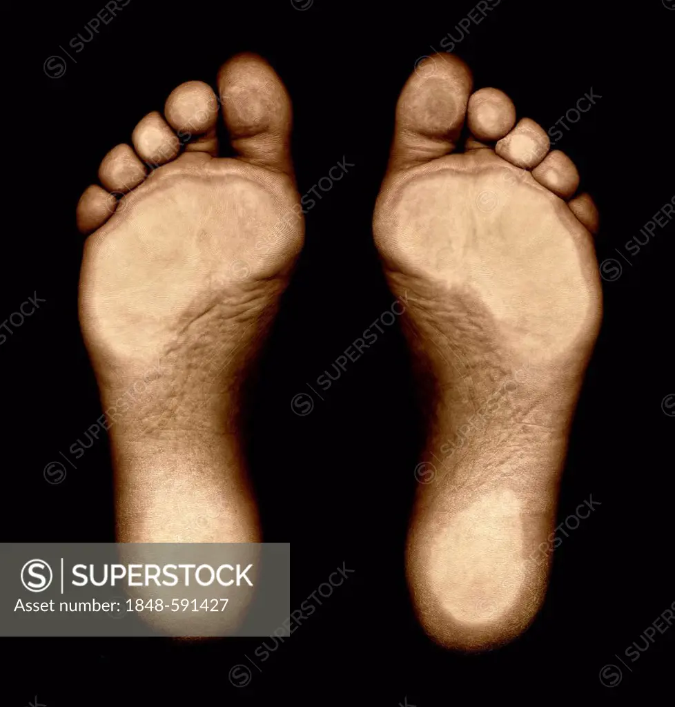 Feet from below, sole of foot with pressure points