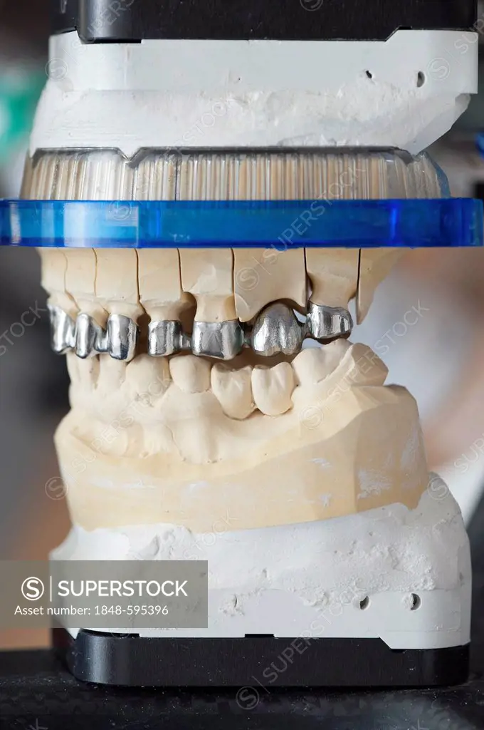 Dental model with of tooth crowns in the articulator