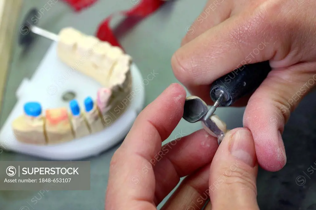 Dental laboratory, manufacture of a dental prosthesis by a master craftsman, grinding, separation of a ceramic-veneered dental bridge