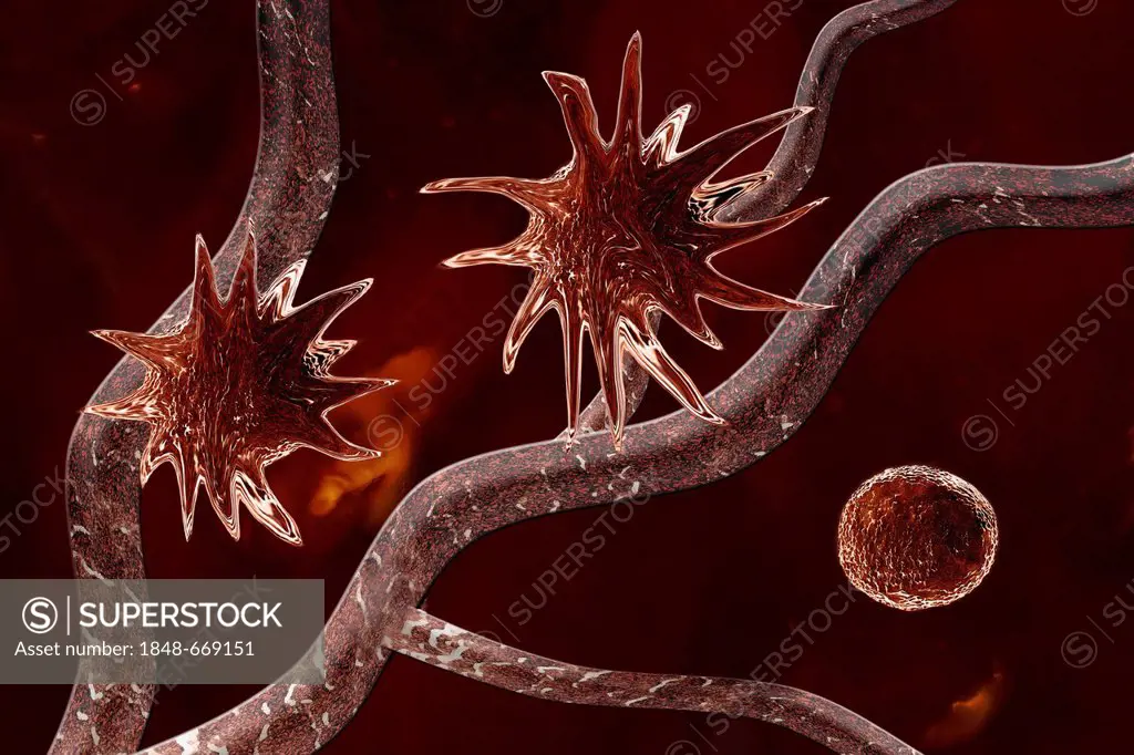 Tumour in an early stage, angiogenesis, illustration