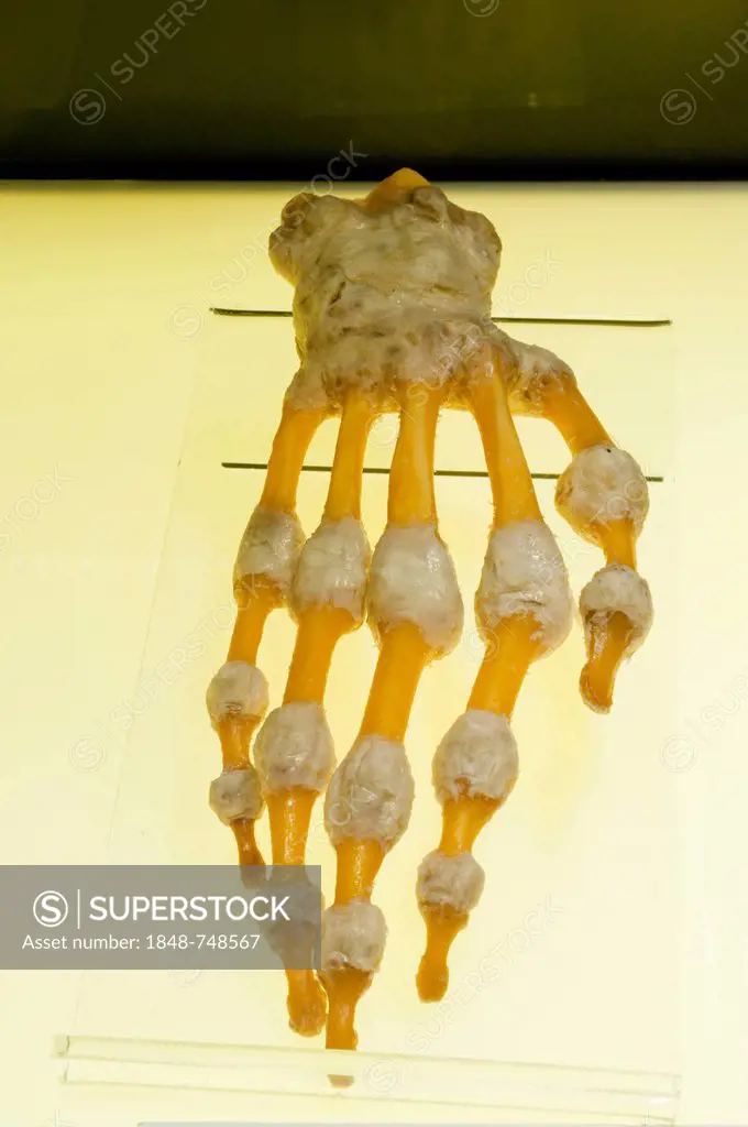 Plastination specimen of bones and joints of hand