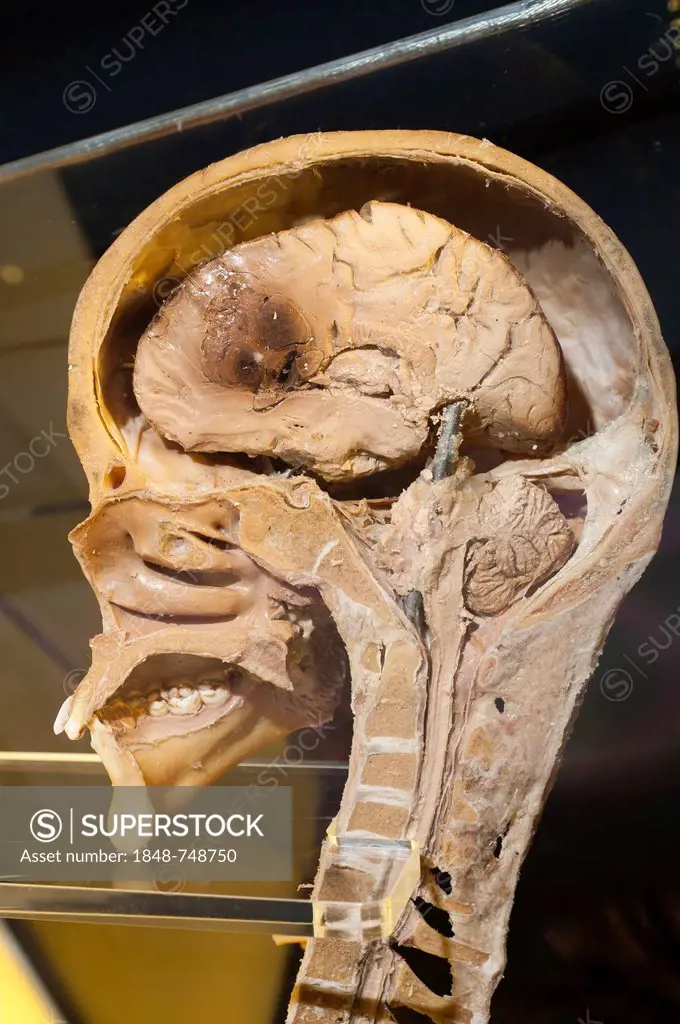 Plastination specimen of sagital section of head and neck