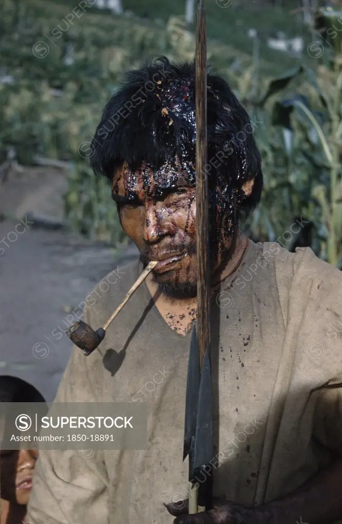 Colombia, Sierra De Perija, Yuko - Motilon ., 'Victim After A Ritual Bow Fight In Which Aim Is To Hit The OpponentS Head. Blood, Now Dried, Has Streamed From Wound. Clutches His Hard  Macana Wood Bow And Quiver Of Arrows, Smoking A Clay Pipe'