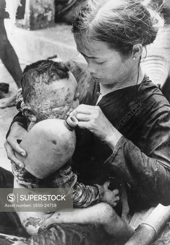 Vietnam, South, Cam Che, Badly Burned Vietnamese Baby Caught In Bursting Napalm Bomb Between Us Marines And North Vietnamese Taking Water From A SoldierS Water Bottle On His MotherS Knee.