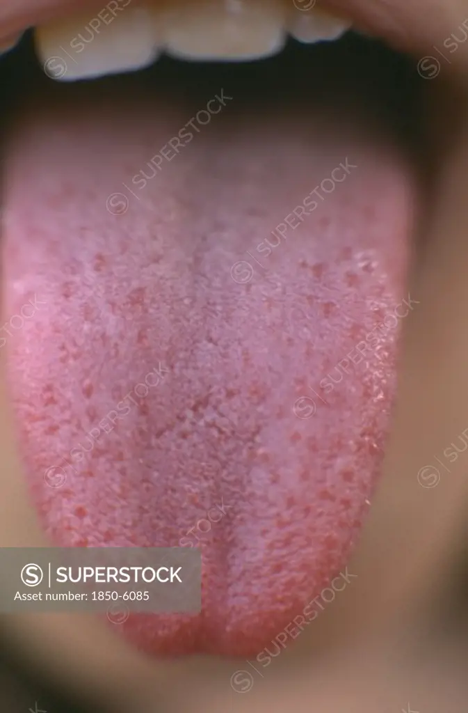 Health, Taste, Close View Of Childs Tongue Showing Taste Buds.