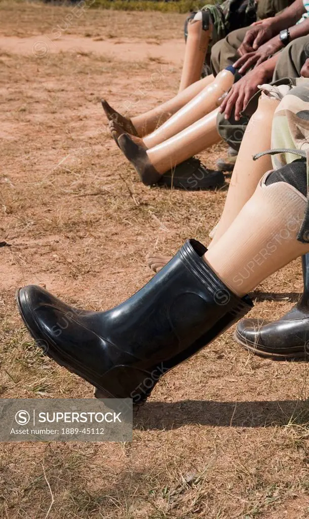 Artificial legs of landmine victims, Burma