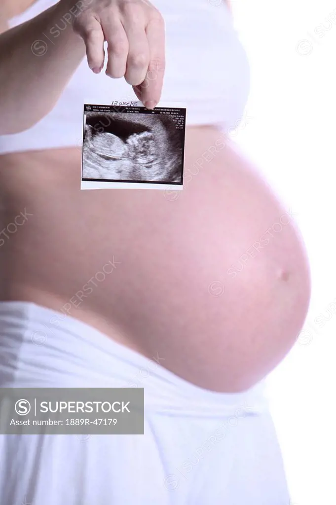 Pregnant lady holding ultrasound picture