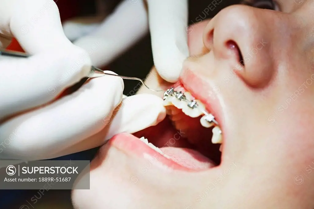 a teenager with braces having their mouth examined by the dentist
